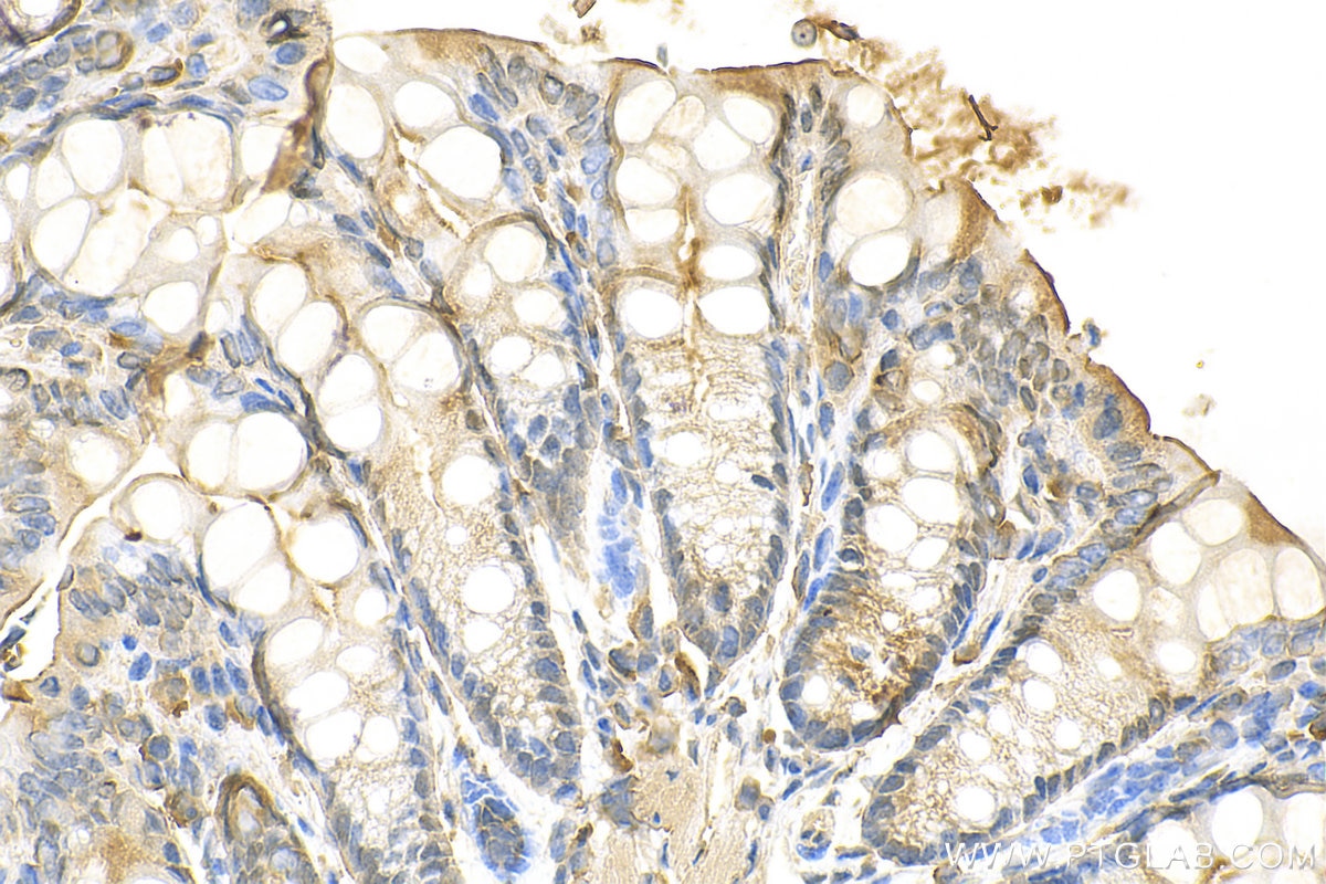 Immunohistochemistry (IHC) staining of mouse colon tissue using GPR112 Polyclonal antibody (31781-1-AP)