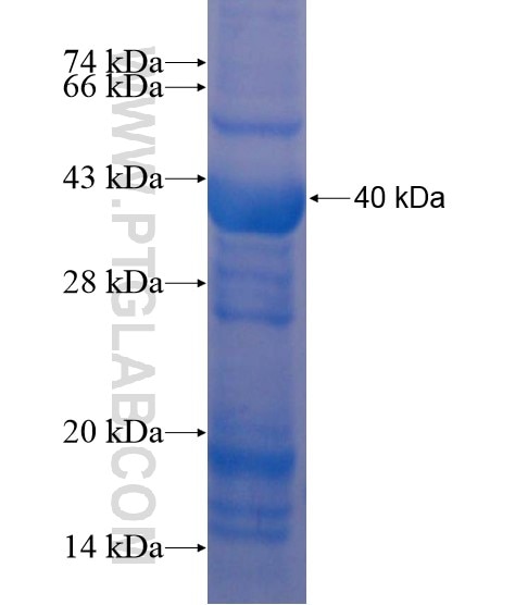GPR113 fusion protein Ag19438 SDS-PAGE
