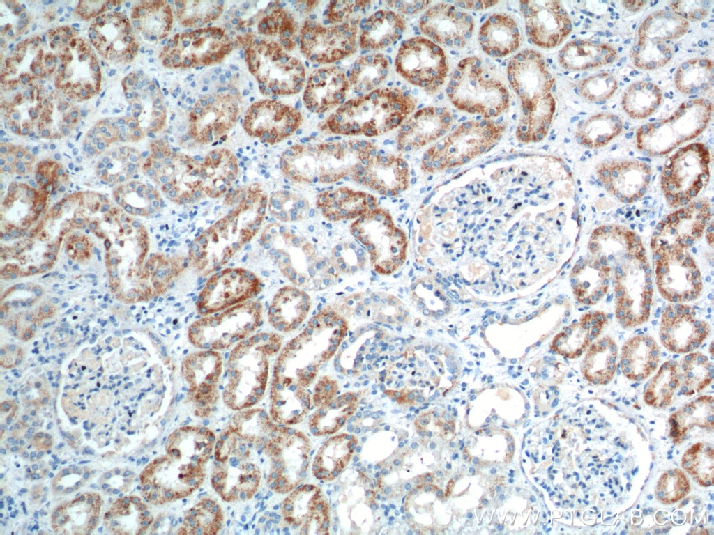 Immunohistochemistry (IHC) staining of human kidney tissue using GPR116 Polyclonal antibody (14047-1-AP)