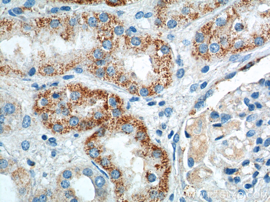 Immunohistochemistry (IHC) staining of human kidney tissue using GPR116 Polyclonal antibody (14047-1-AP)