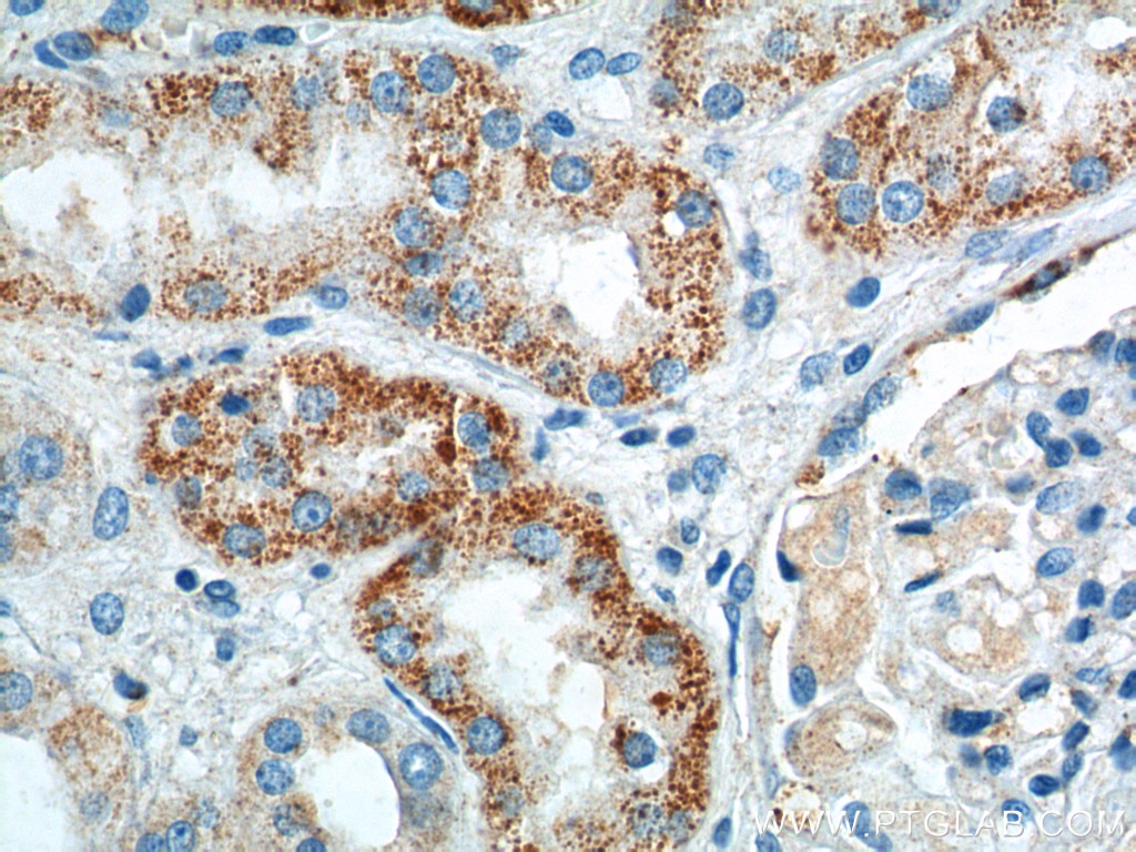 IHC staining of human kidney using 14047-1-AP