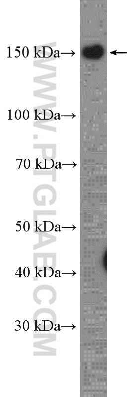 Western Blot (WB) analysis of HeLa cells using GPR116 Polyclonal antibody (14047-1-AP)