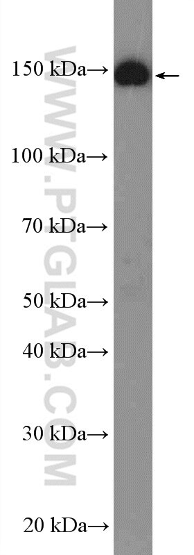 Western Blot (WB) analysis of HEK-293 cells using GPR116 Polyclonal antibody (14047-1-AP)