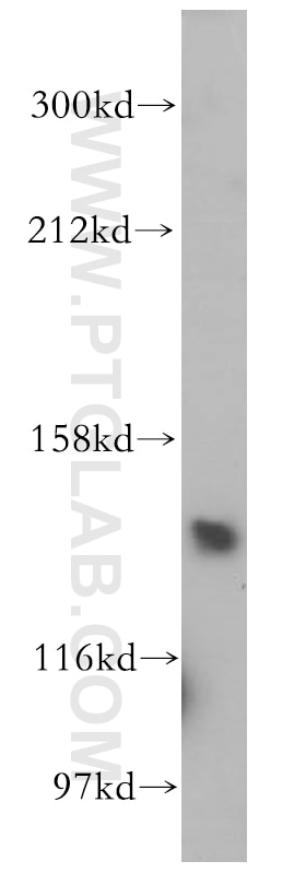 Western Blot (WB) analysis of Y79 cells using GPR116 Polyclonal antibody (14047-1-AP)