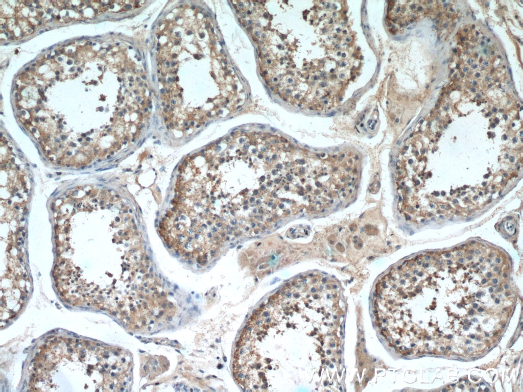 Immunohistochemistry (IHC) staining of human testis tissue using GPR123-Specific Polyclonal antibody (20075-1-AP)