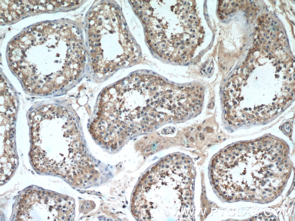 IHC staining of human testis using 20075-1-AP