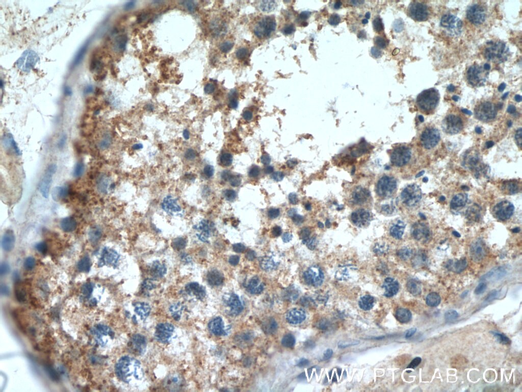 IHC staining of human testis using 20075-1-AP