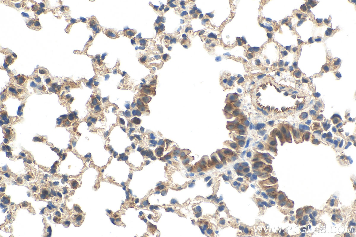 Immunohistochemistry (IHC) staining of mouse lung tissue using GPR124 Polyclonal antibody (20050-1-AP)
