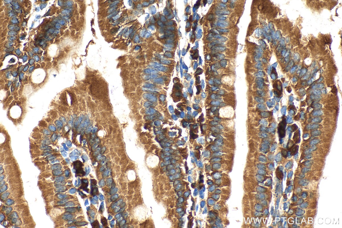 Immunohistochemistry (IHC) staining of mouse small intestine tissue using GPR124 Polyclonal antibody (20050-1-AP)