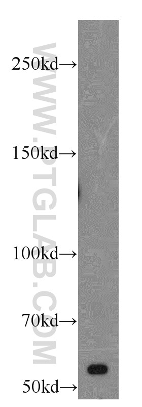 GPR124