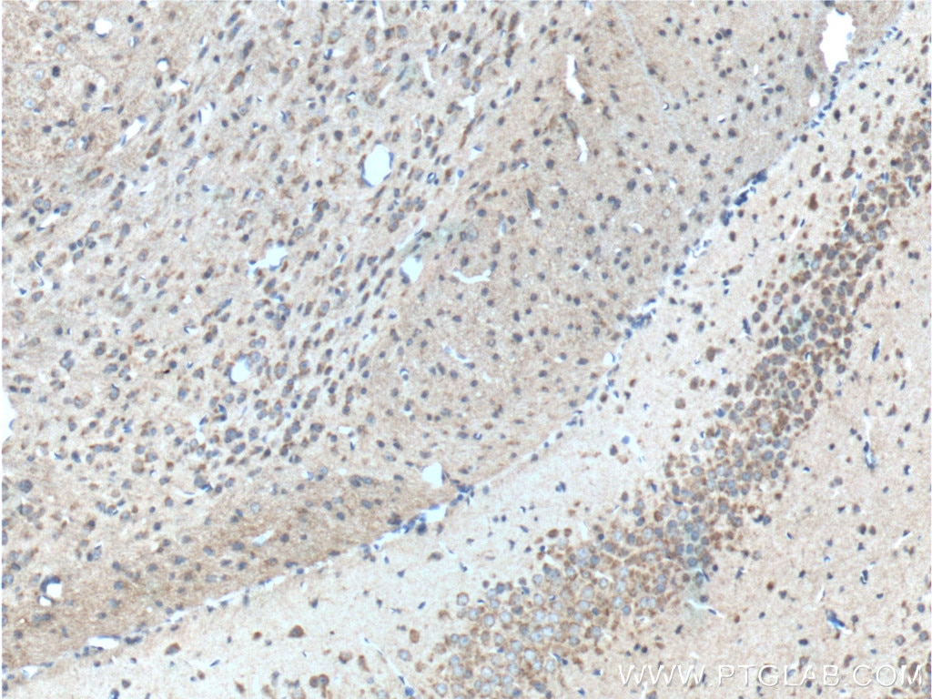 Immunohistochemistry (IHC) staining of mouse brain tissue using GPR125 Polyclonal antibody (11912-1-AP)