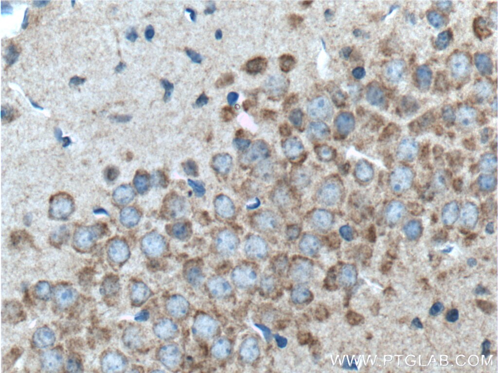 Immunohistochemistry (IHC) staining of mouse brain tissue using GPR125 Polyclonal antibody (11912-1-AP)