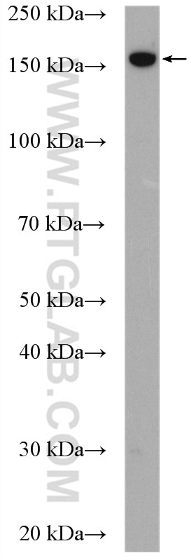 Western Blot (WB) analysis of pig brain tissue using GPR125 Polyclonal antibody (11912-1-AP)