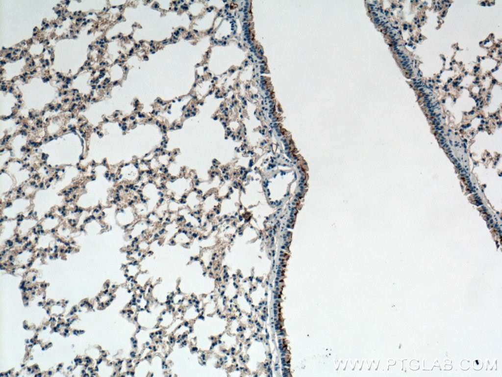 Immunohistochemistry (IHC) staining of mouse lung tissue using GPR126 Polyclonal antibody (17774-1-AP)
