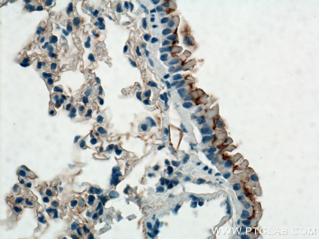 Immunohistochemistry (IHC) staining of mouse lung tissue using GPR126 Polyclonal antibody (17774-1-AP)
