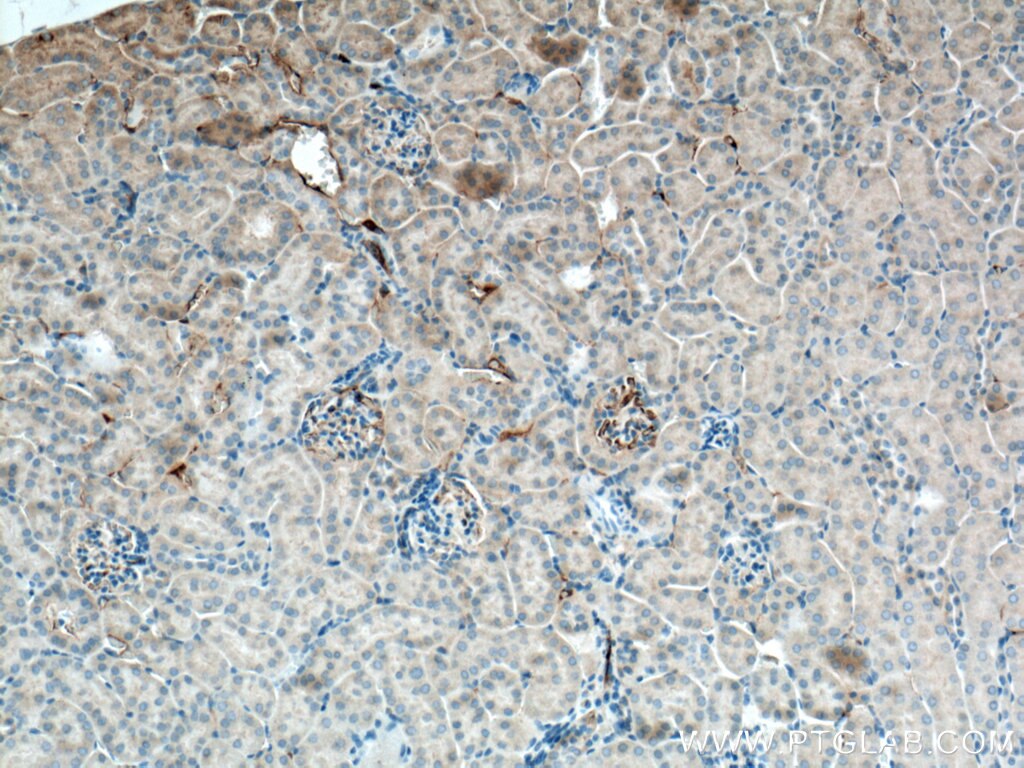 Immunohistochemistry (IHC) staining of mouse kidney tissue using GPR126 Polyclonal antibody (17774-1-AP)