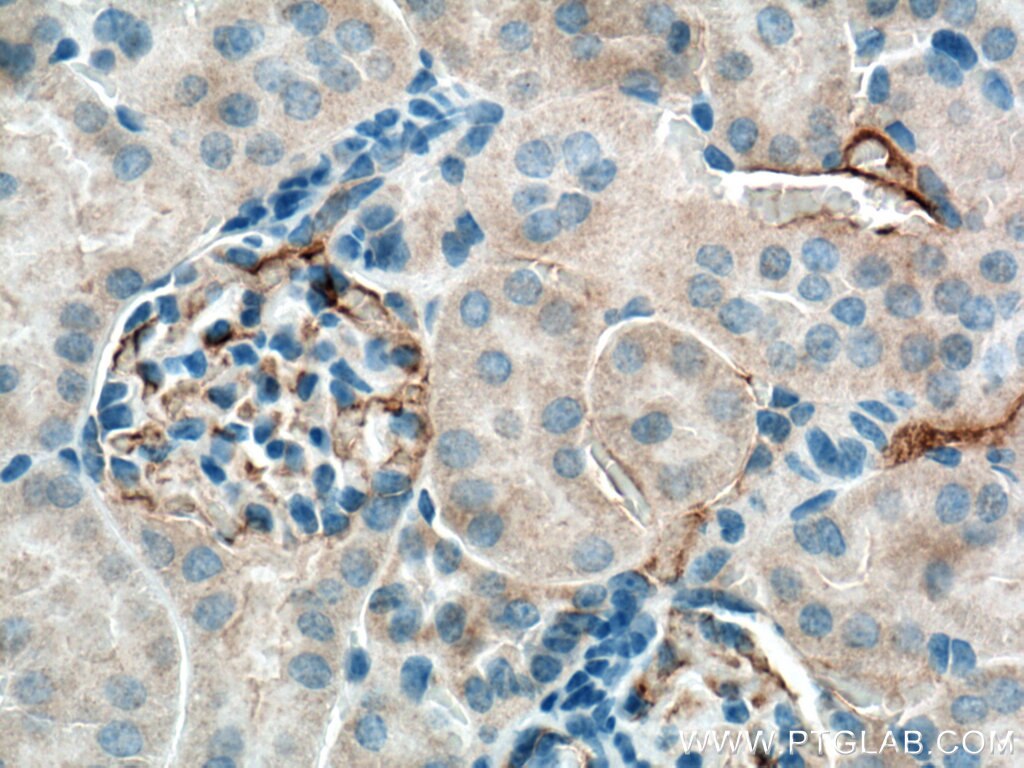 Immunohistochemistry (IHC) staining of mouse kidney tissue using GPR126 Polyclonal antibody (17774-1-AP)