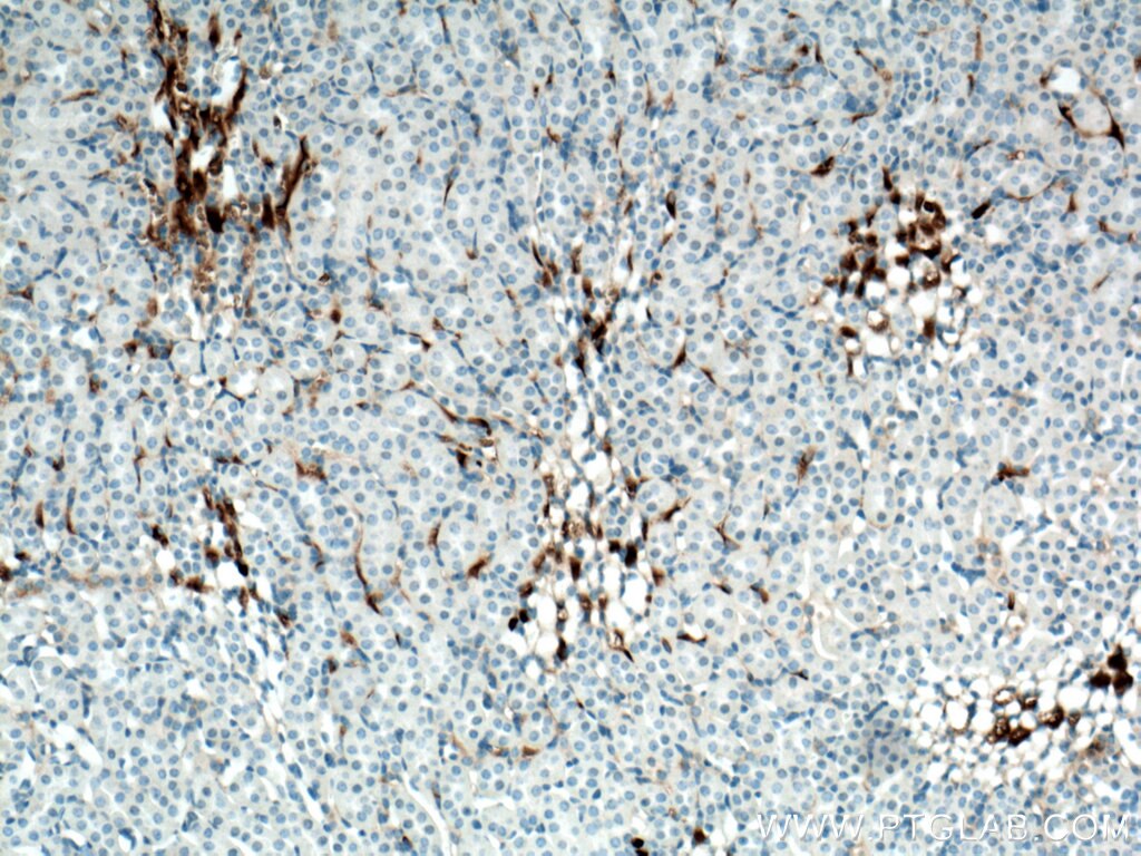 Immunohistochemistry (IHC) staining of mouse kidney tissue using GPR126 Polyclonal antibody (17774-1-AP)