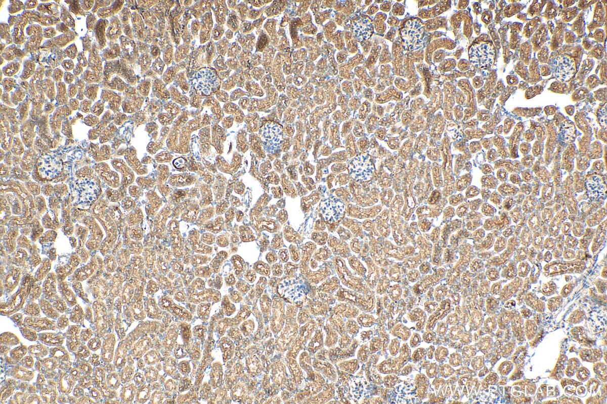 Immunohistochemistry (IHC) staining of mouse kidney tissue using GPR126 Polyclonal antibody (17774-1-AP)