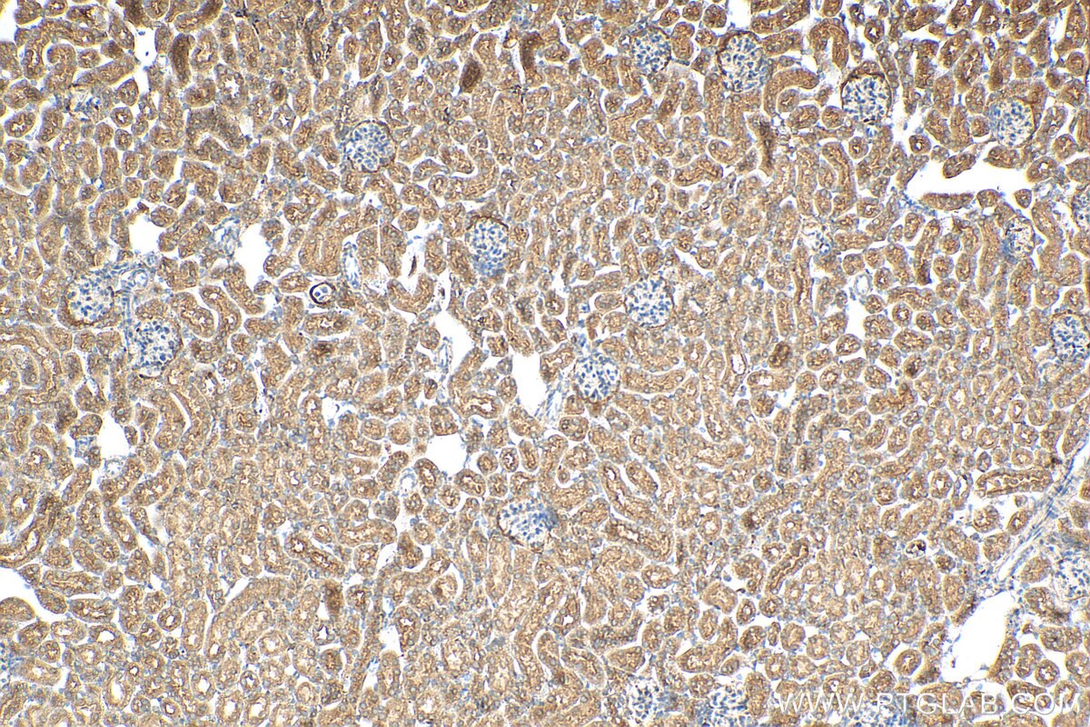 Immunohistochemistry (IHC) staining of mouse kidney tissue using GPR126 Polyclonal antibody (17774-1-AP)