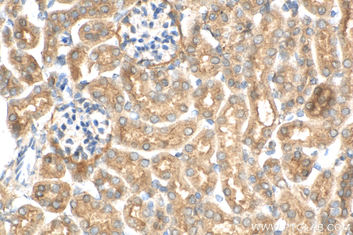 Immunohistochemistry (IHC) staining of mouse kidney tissue using GPR126 Polyclonal antibody (17774-1-AP)