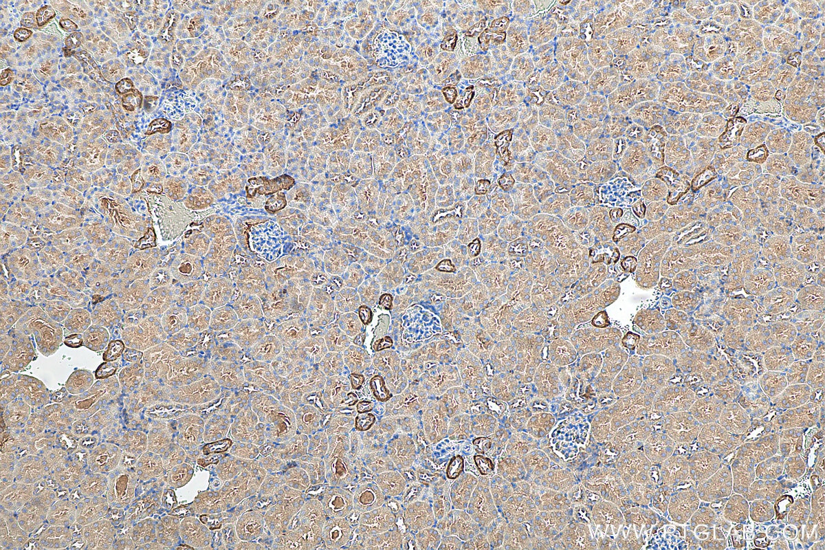 Immunohistochemistry (IHC) staining of mouse kidney tissue using GPR126 Recombinant antibody (81632-1-RR)