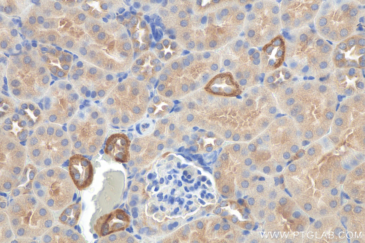 Immunohistochemistry (IHC) staining of mouse kidney tissue using GPR126 Recombinant antibody (81632-1-RR)