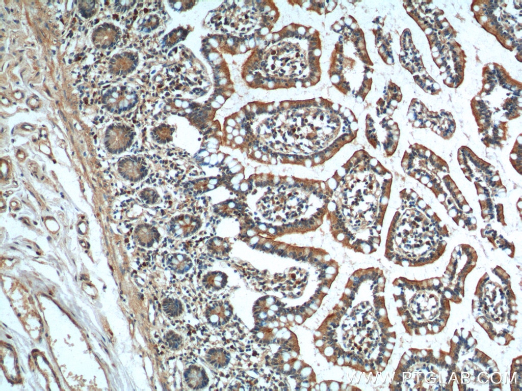 Immunohistochemistry (IHC) staining of human small intestine tissue using GPR128 Polyclonal antibody (24784-1-AP)