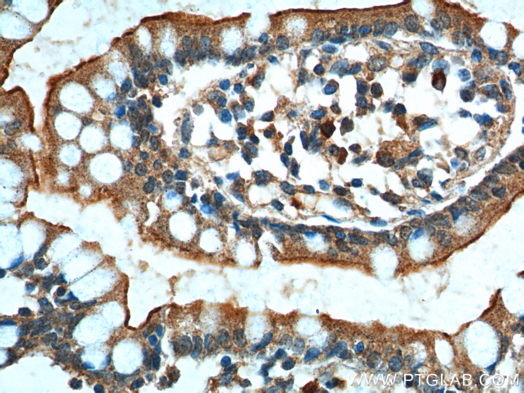 Immunohistochemistry (IHC) staining of human small intestine tissue using GPR128 Polyclonal antibody (24784-1-AP)