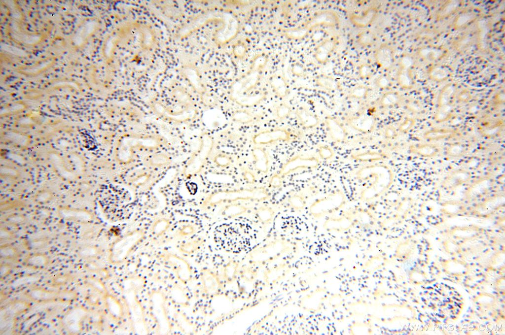 Immunohistochemistry (IHC) staining of human kidney tissue using GPR132 Polyclonal antibody (17026-1-AP)