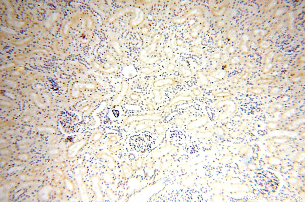 IHC staining of human kidney using 17026-1-AP