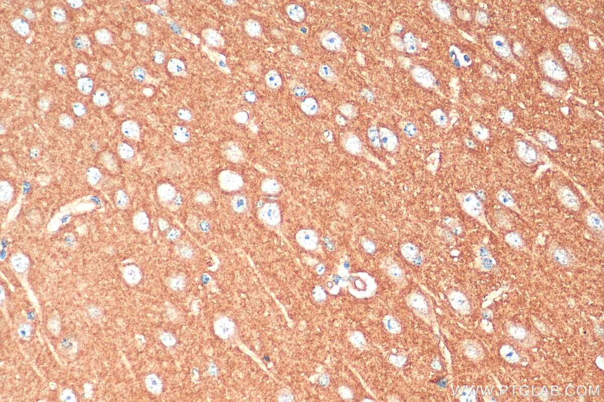 Immunohistochemistry (IHC) staining of mouse brain tissue using GPR137 Polyclonal antibody (11929-1-AP)