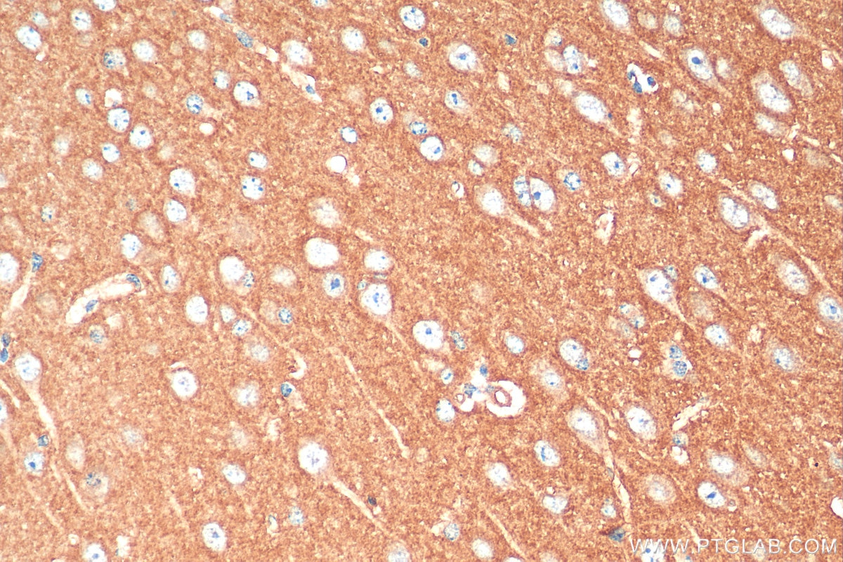 IHC staining of mouse brain using 11929-1-AP