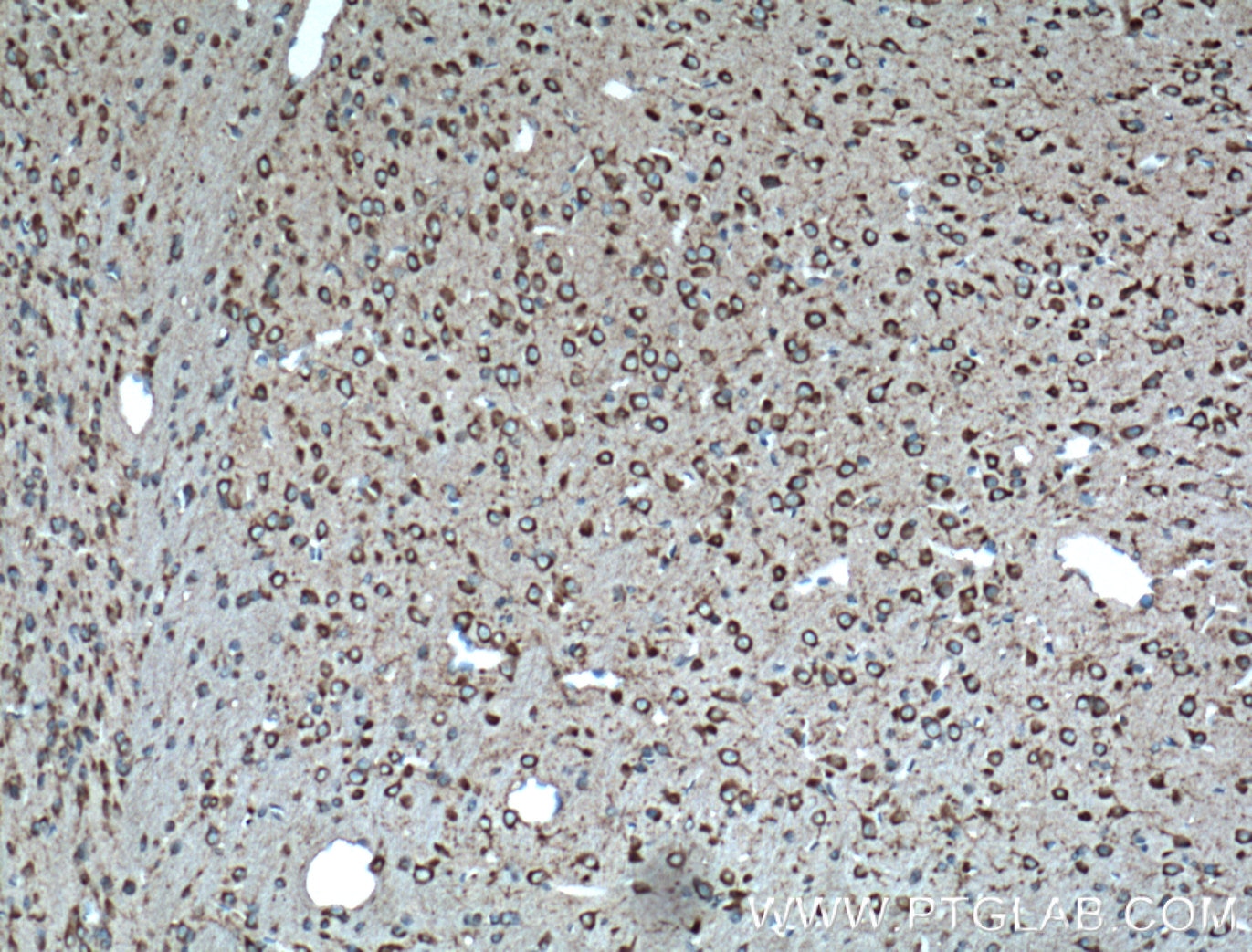 Immunohistochemistry (IHC) staining of mouse brain tissue using GPR137 Polyclonal antibody (11929-1-AP)