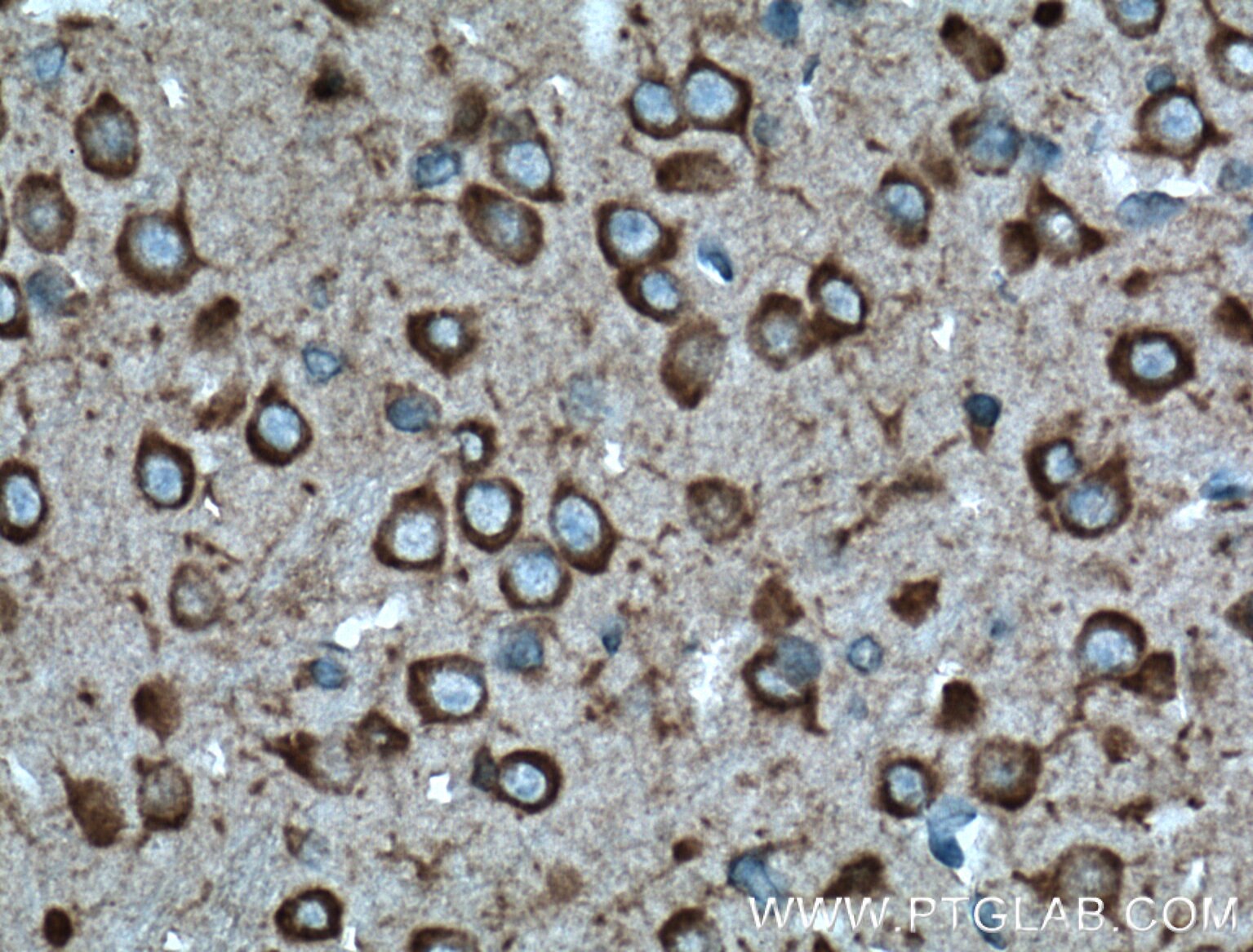 Immunohistochemistry (IHC) staining of mouse brain tissue using GPR137 Polyclonal antibody (11929-1-AP)