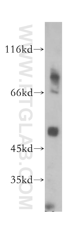 Western Blot (WB) analysis of human heart tissue using GPR137B Polyclonal antibody (16496-1-AP)