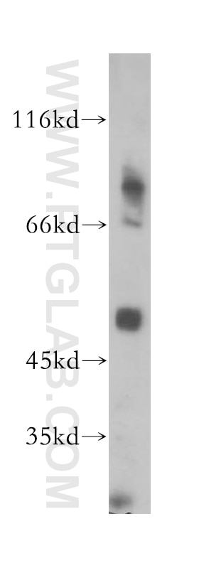 WB analysis of human heart using 16496-1-AP
