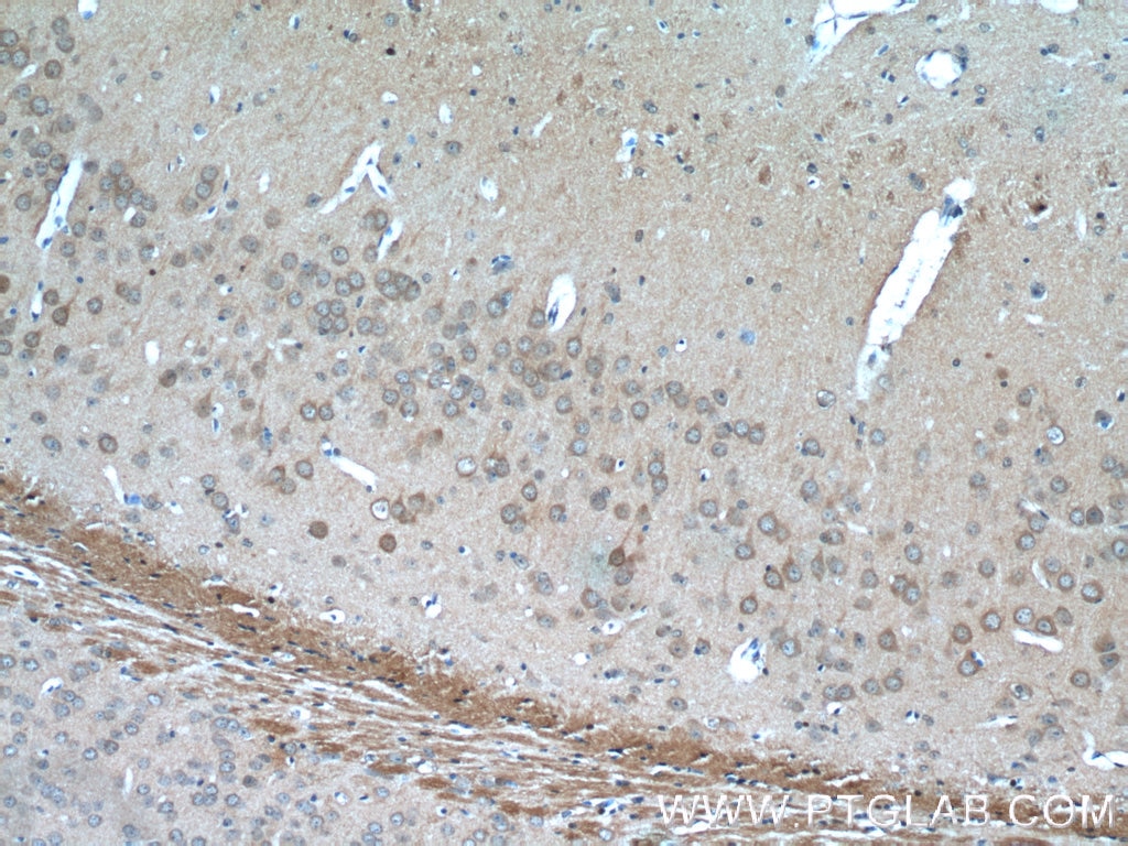 Immunohistochemistry (IHC) staining of mouse brain tissue using GPR139-Specific Polyclonal antibody (20083-1-AP)