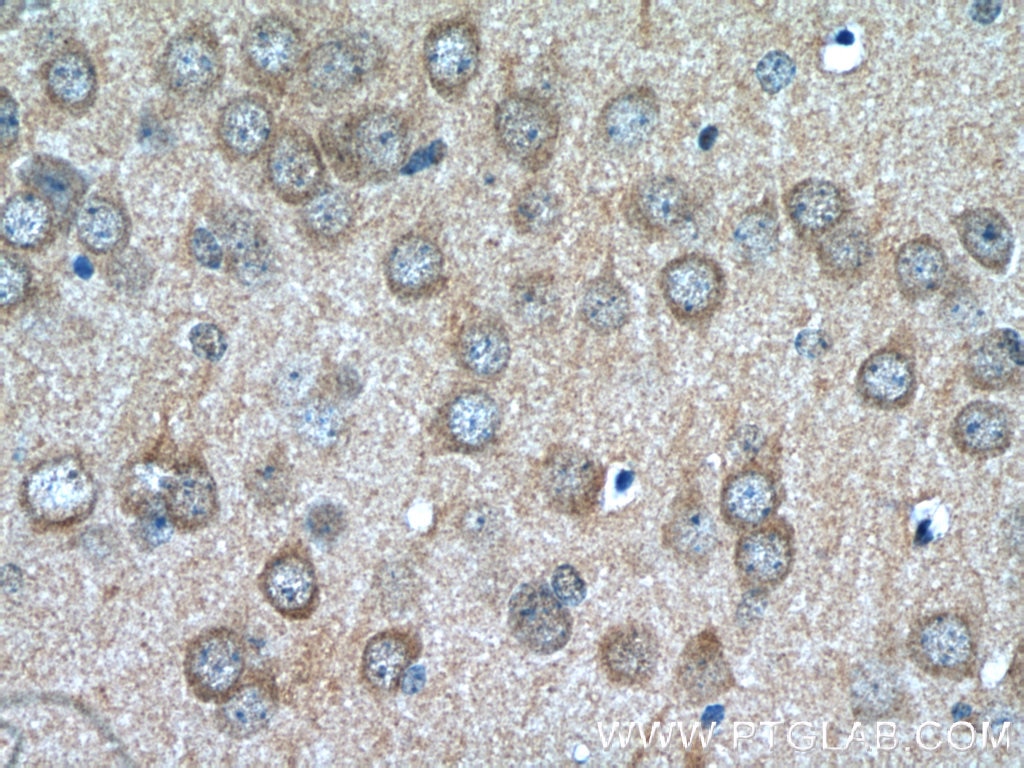 Immunohistochemistry (IHC) staining of mouse brain tissue using GPR139-Specific Polyclonal antibody (20083-1-AP)