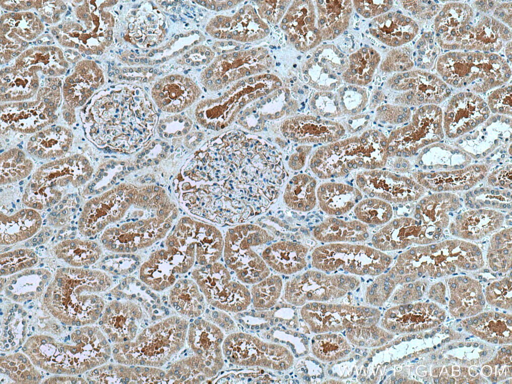 Immunohistochemistry (IHC) staining of human kidney tissue using GPR141 Polyclonal antibody (28096-1-AP)