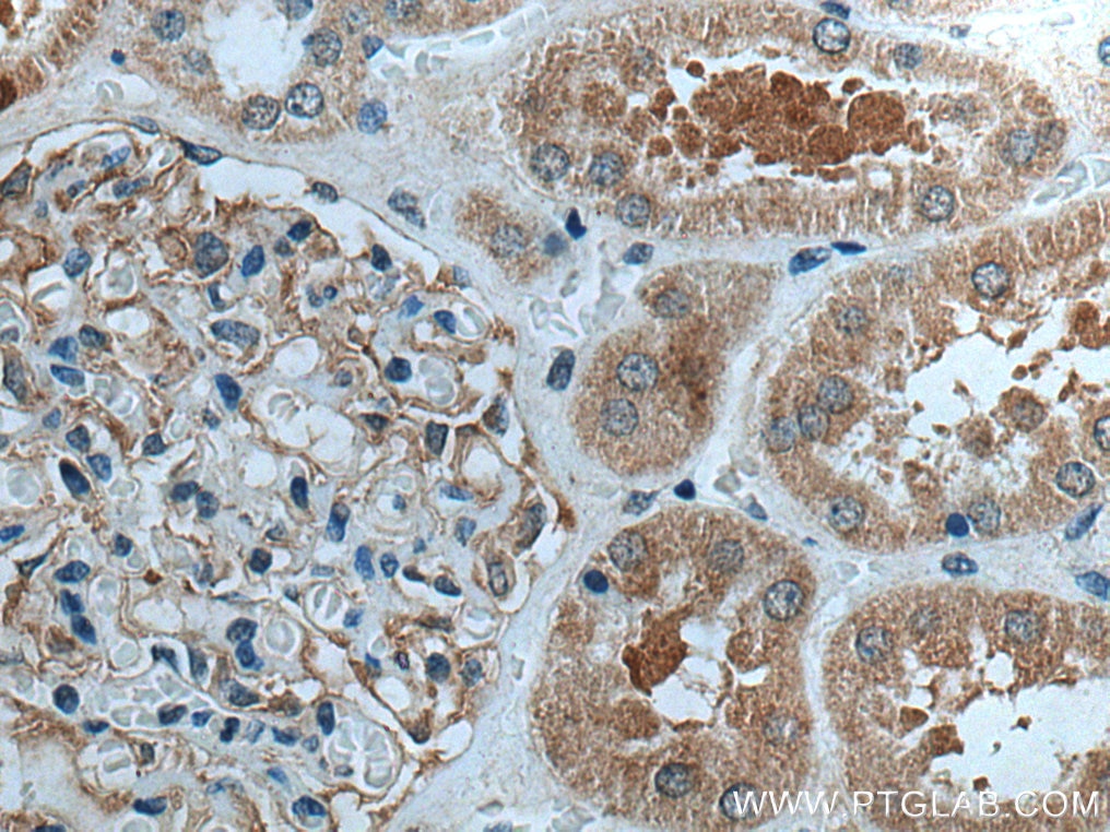 Immunohistochemistry (IHC) staining of human kidney tissue using GPR141 Polyclonal antibody (28096-1-AP)