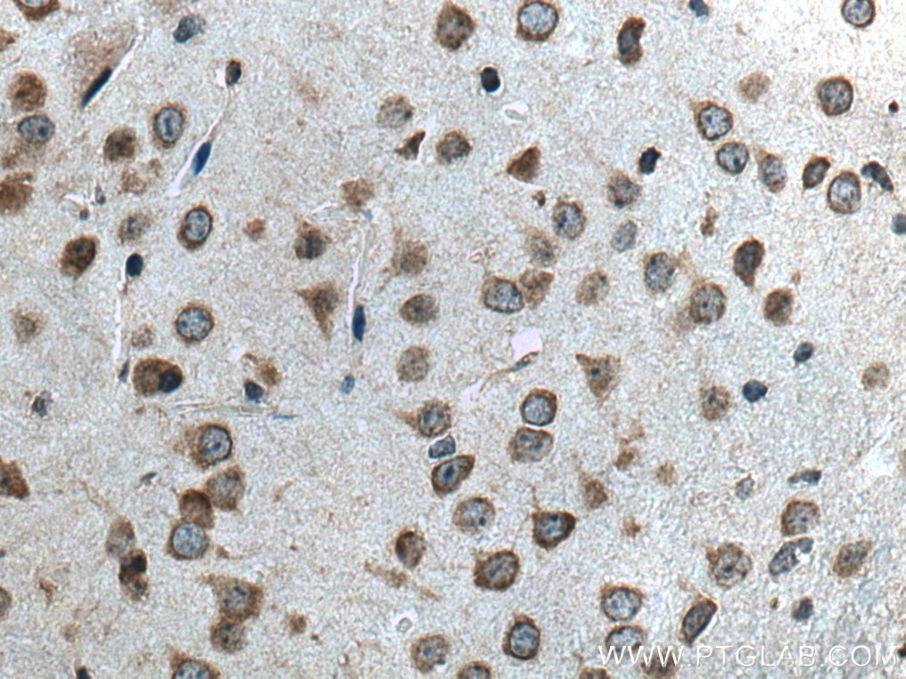 Immunohistochemistry (IHC) staining of mouse brain tissue using GPR141 Polyclonal antibody (28096-1-AP)