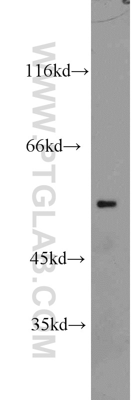 Western Blot (WB) analysis of SH-SY5Y cells using GPR142 Polyclonal antibody (18820-1-AP)