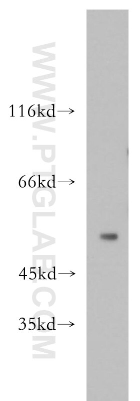 Western Blot (WB) analysis of SH-SY5Y cells using GPR142 Polyclonal antibody (18820-1-AP)