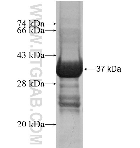 GPR143 fusion protein Ag14290 SDS-PAGE