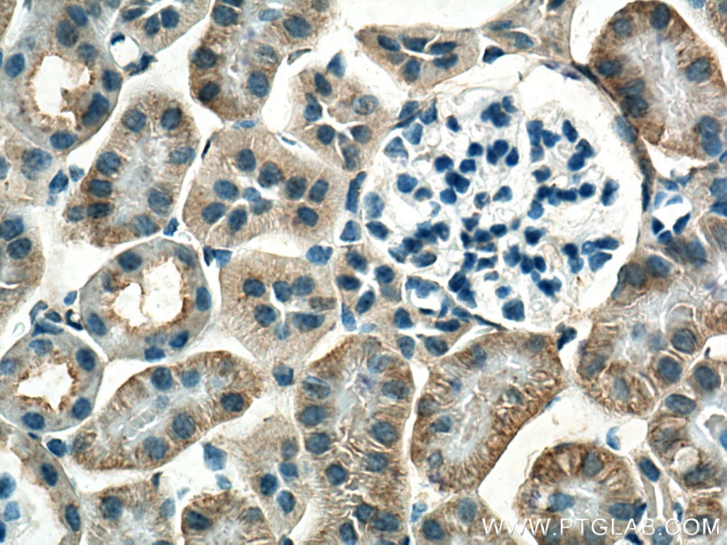 Immunohistochemistry (IHC) staining of mouse kidney tissue using GPR146 Polyclonal antibody (16334-1-AP)