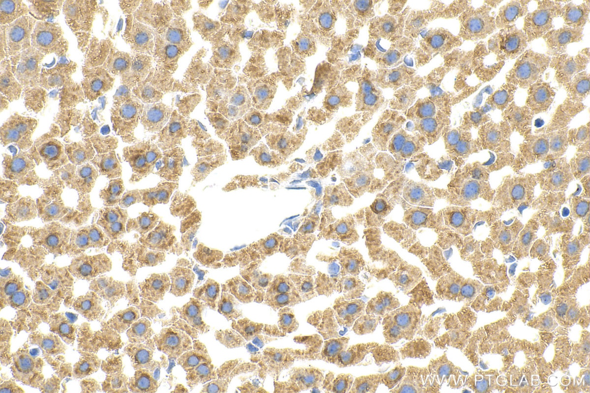 Immunohistochemistry (IHC) staining of mouse liver tissue using GPR146 Polyclonal antibody (16334-1-AP)
