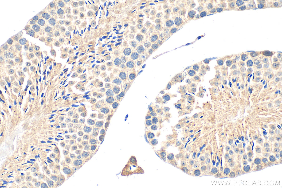 Immunohistochemical analysis of paraffin-embedded mouse testis tissue slide using 25996-1-AP (GPR148 antibody) at dilution of 1:200 (under 40x lens). Heat mediated antigen retrieval with Tris-EDTA buffer (pH 9.0). Immunohistochemistry (IHC) staining of mouse testis tissue using GPR148 Polyclonal antibody (25996-1-AP)