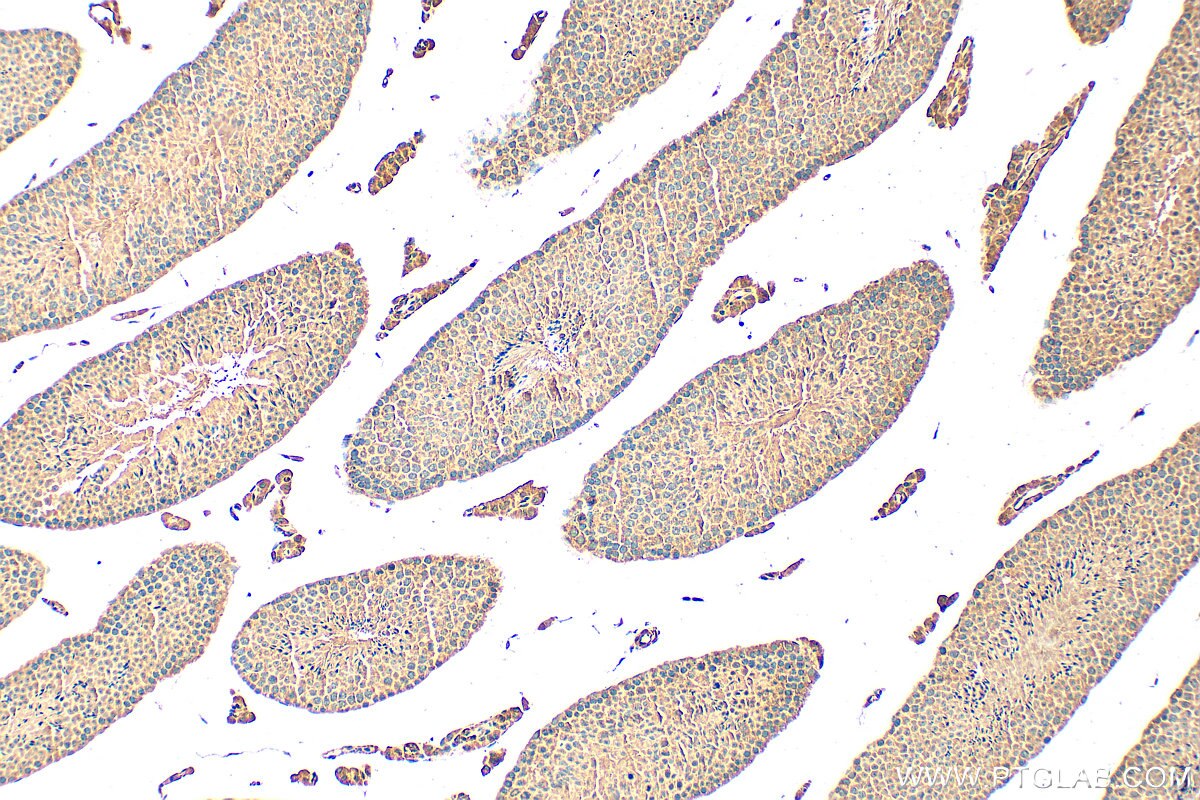 Immunohistochemical analysis of paraffin-embedded mouse testis tissue slide using 25996-1-AP (GPR148 antibody) at dilution of 1:200 (under 10x lens). Heat mediated antigen retrieval with Tris-EDTA buffer (pH 9.0). Immunohistochemistry (IHC) staining of mouse testis tissue using GPR148 Polyclonal antibody (25996-1-AP)