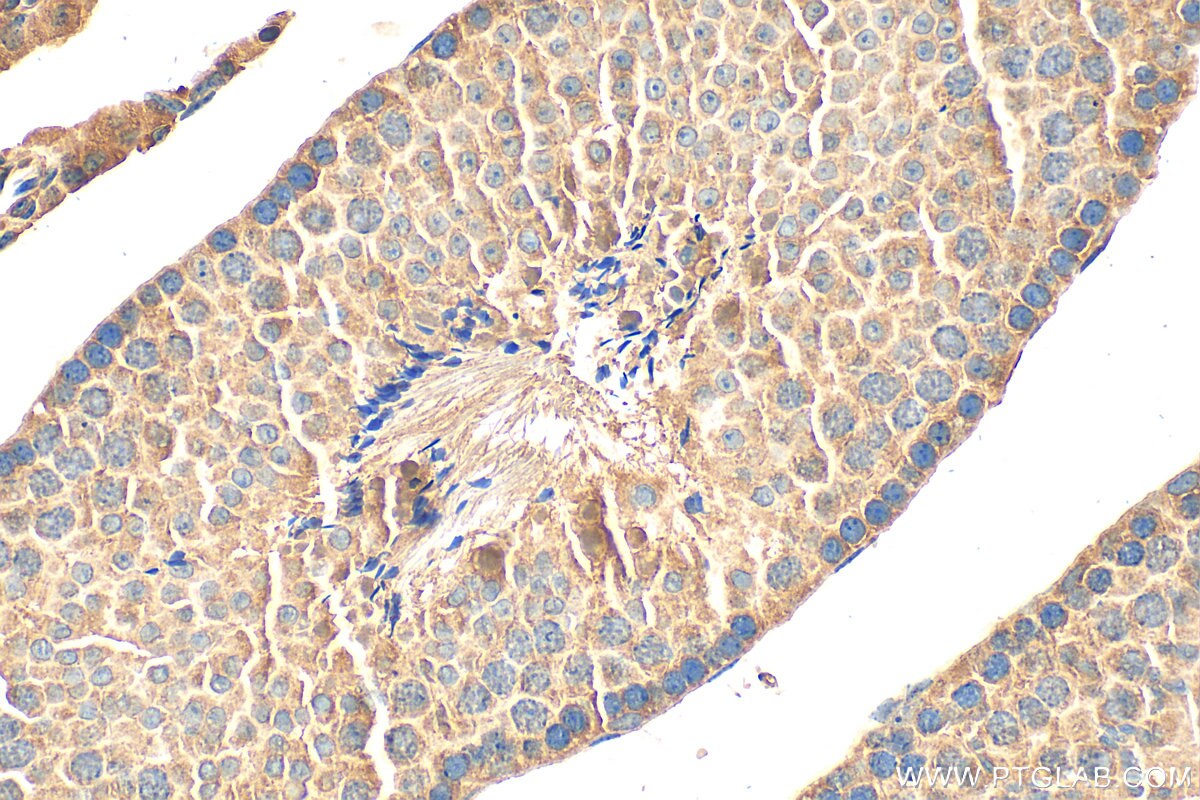 Immunohistochemical analysis of paraffin-embedded mouse testis tissue slide using 25996-1-AP (GPR148 antibody) at dilution of 1:200 (under 40x lens). Heat mediated antigen retrieval with Tris-EDTA buffer (pH 9.0). Immunohistochemistry (IHC) staining of mouse testis tissue using GPR148 Polyclonal antibody (25996-1-AP)